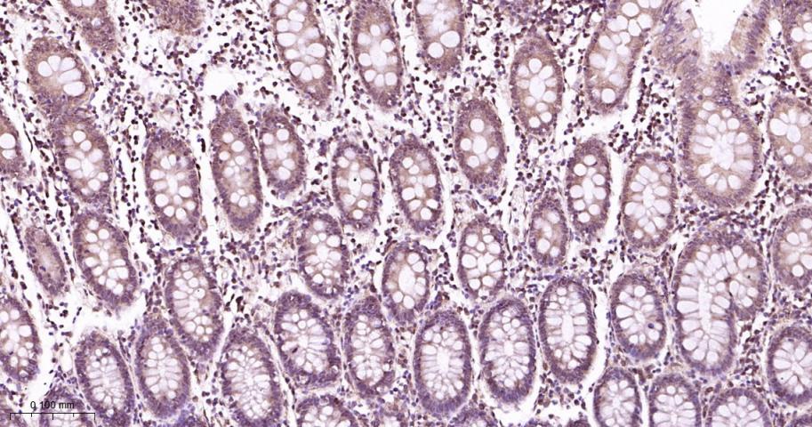 蛋白酶调解因子14重组兔单抗