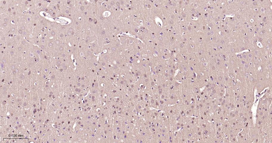 丝裂原活化蛋白激酶1/ERK 1/2重组兔单抗