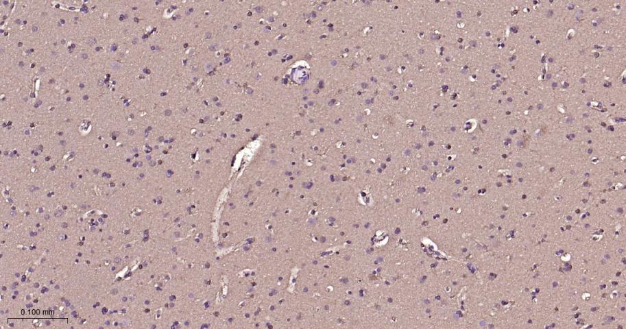 丝裂原活化蛋白激酶1/ERK 1/2重组兔单抗