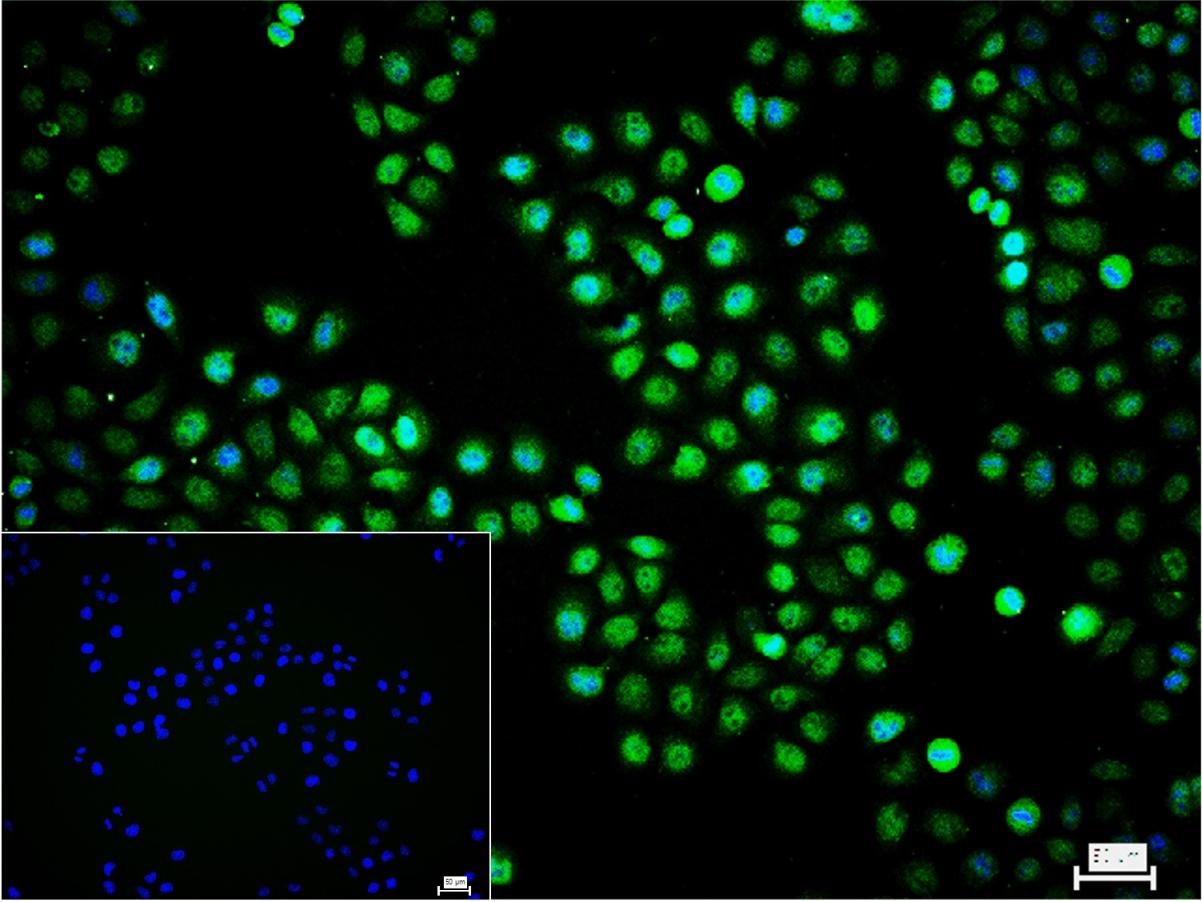 缺氧诱导因子1α 单克隆抗体-bsm-33428M