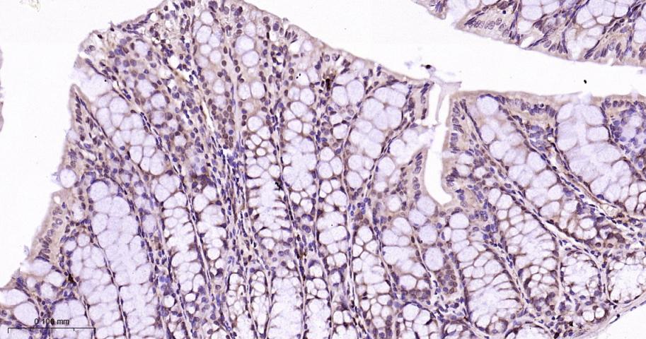 蛋白酶调解因子14重组兔单抗
