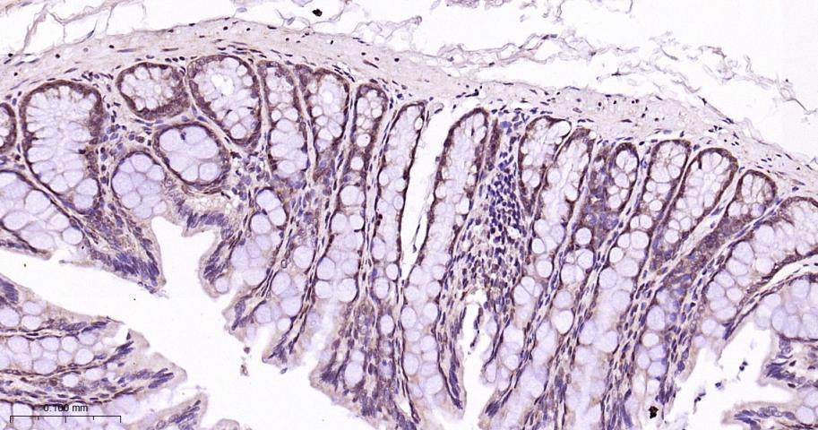 蛋白酶调解因子14重组兔单抗