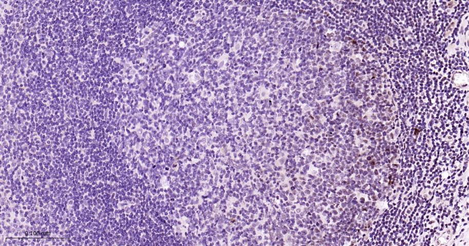 磷酸化MEK1重组兔单抗-bsm-62900R