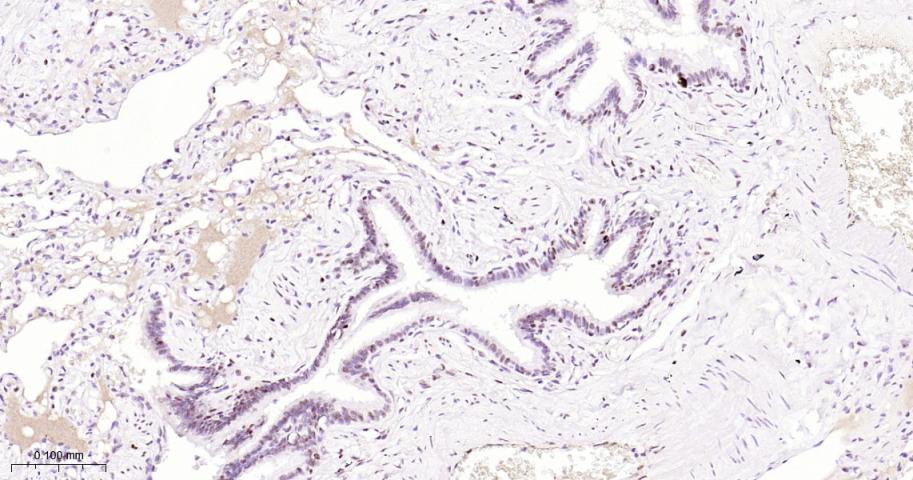 叉头蛋白P1重组兔单抗