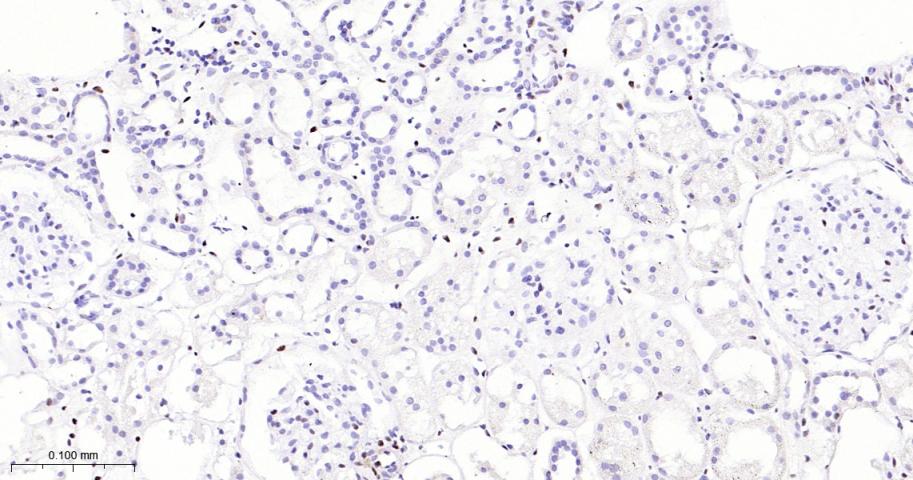磷酸化信号转导和转录激活因子3重组兔单抗