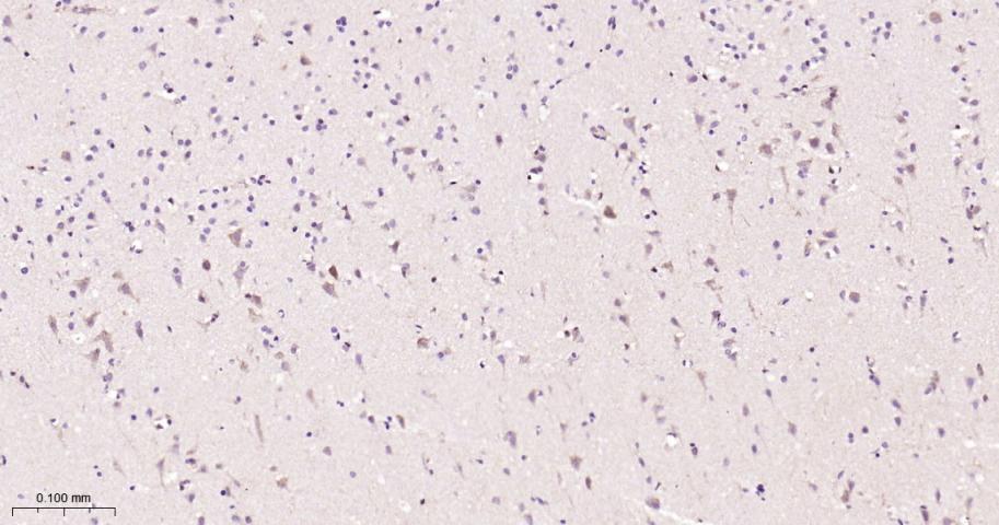 信号转导和转录激活因子3单克隆抗体-bsm-33218M