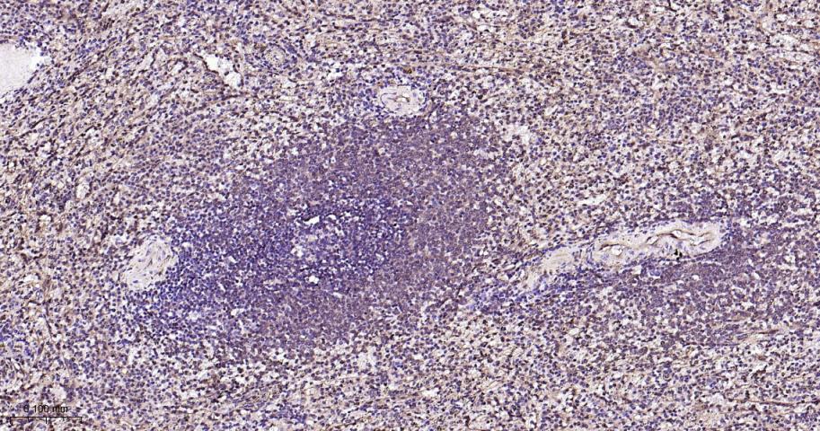 丝裂原活化蛋白激酶1/ERK 1/2重组兔单抗