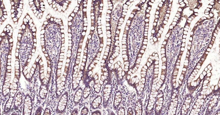 信号转导和转录激活因子3抗体-bs-20382R