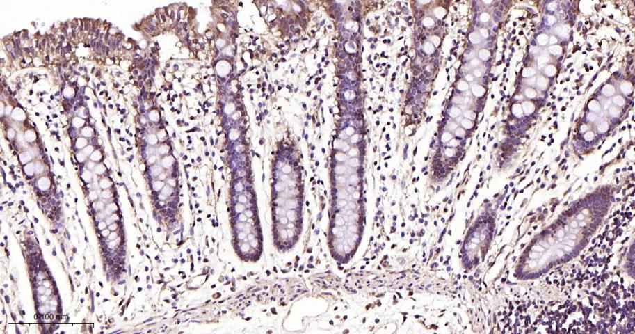 丝裂原活化蛋白激酶1/ERK 1/2重组兔单抗