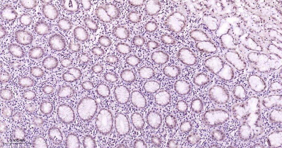 磷酸化MEK1重组兔单抗-bsm-62900R