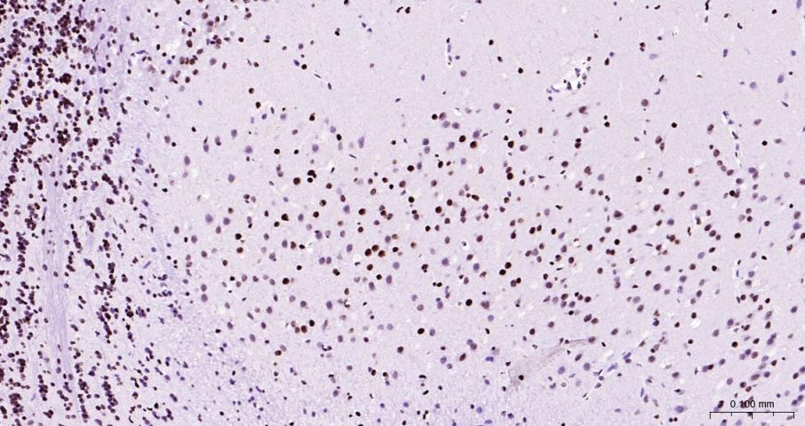 磷酸化RNA聚合酶II CTD重组兔单抗