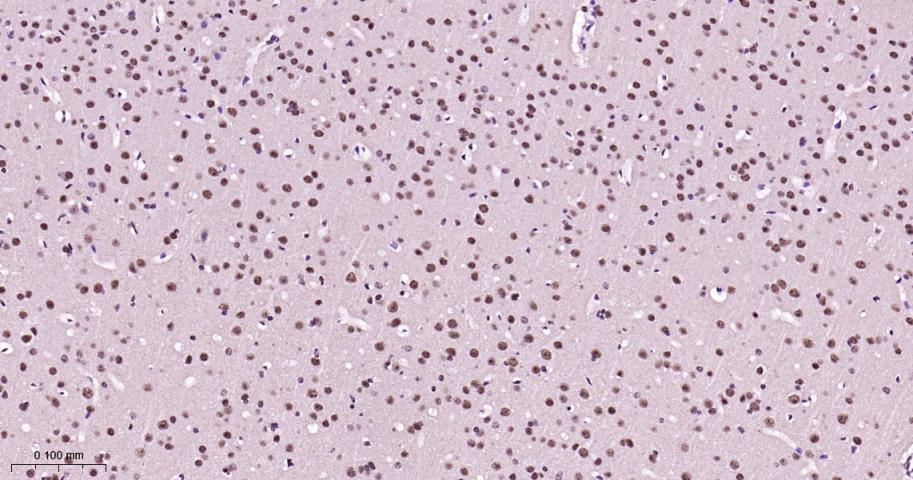 异染色质蛋白1-γ/HP-1γ重组兔单抗-bsm-61603R