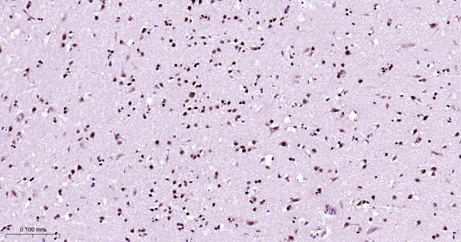 异染色质蛋白1-α重组兔单抗-bsm-61202R