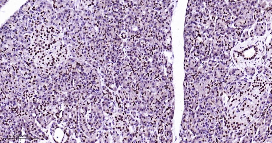 异染色质蛋白1-α重组兔单抗-bsm-61202R