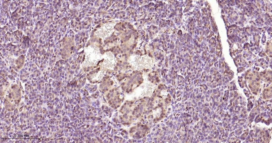 丝裂原活化蛋白激酶1/ERK 1/2重组兔单抗