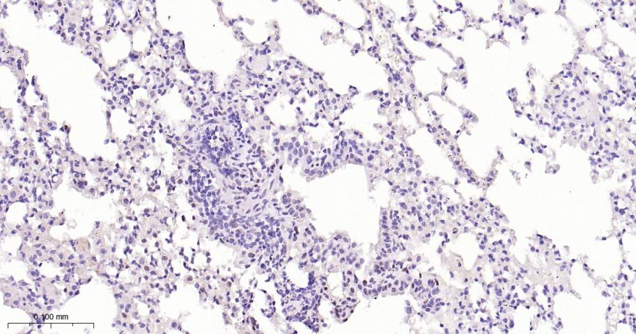 磷酸化信号转导和转录激活因子3重组兔单抗