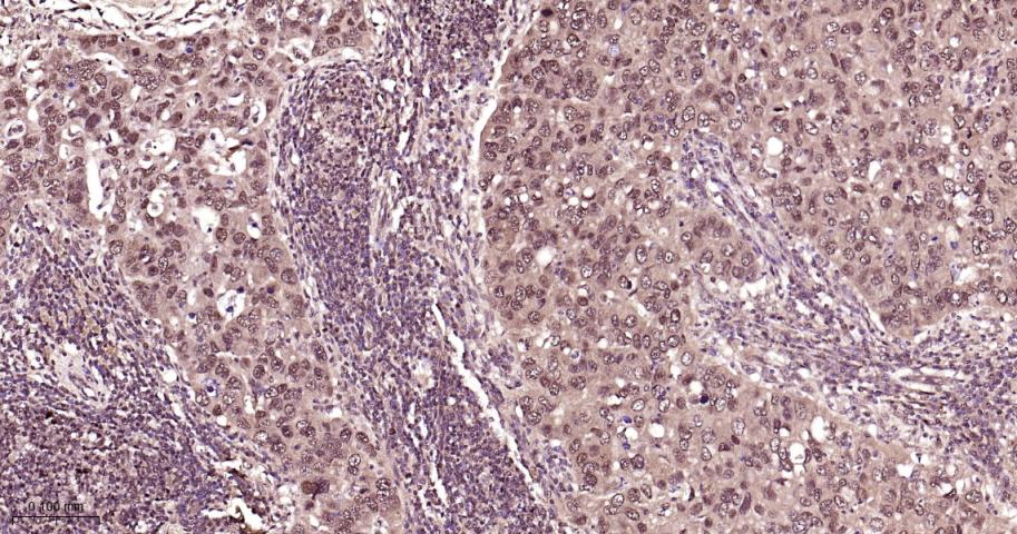 NADPH氧化酶4抗体