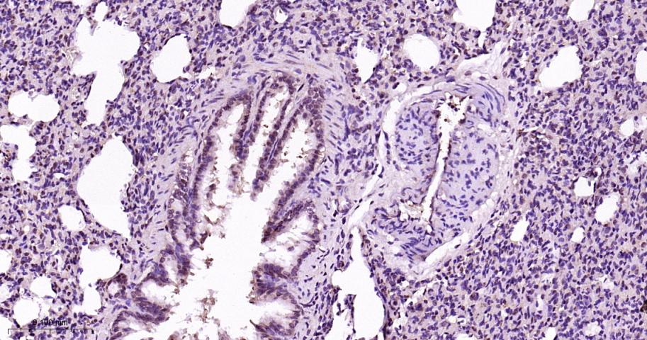 蛋白酶调解因子14重组兔单抗