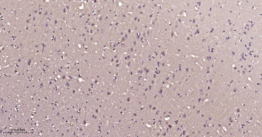 丝裂原活化蛋白激酶1/ERK 1/2重组兔单抗