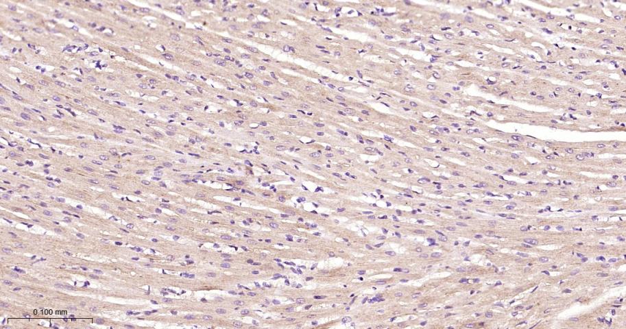 信号转导和转录激活因子3抗体-bs-20382R