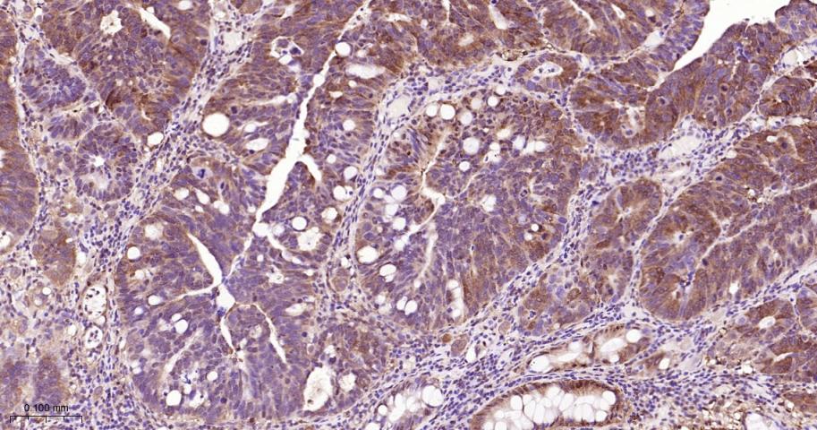信号转导和转录激活因子3单克隆抗体-bsm-33223M