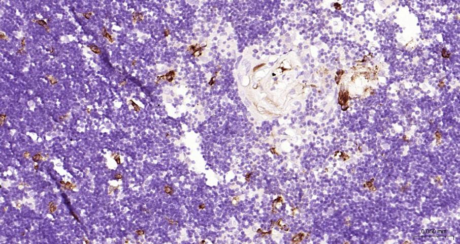 组织蛋白酶B重组兔单抗