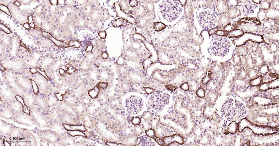 信号转导和转录激活因子3抗体-bs-20382R