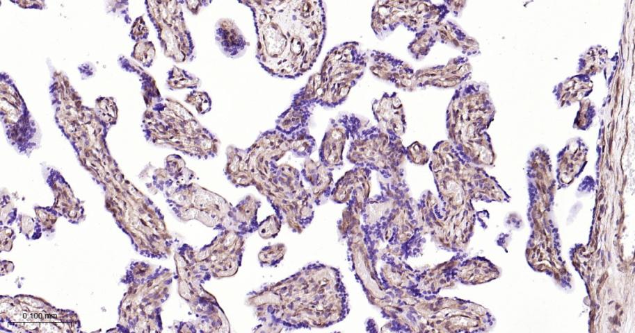 丝裂原活化蛋白激酶1/ERK 1/2重组兔单抗