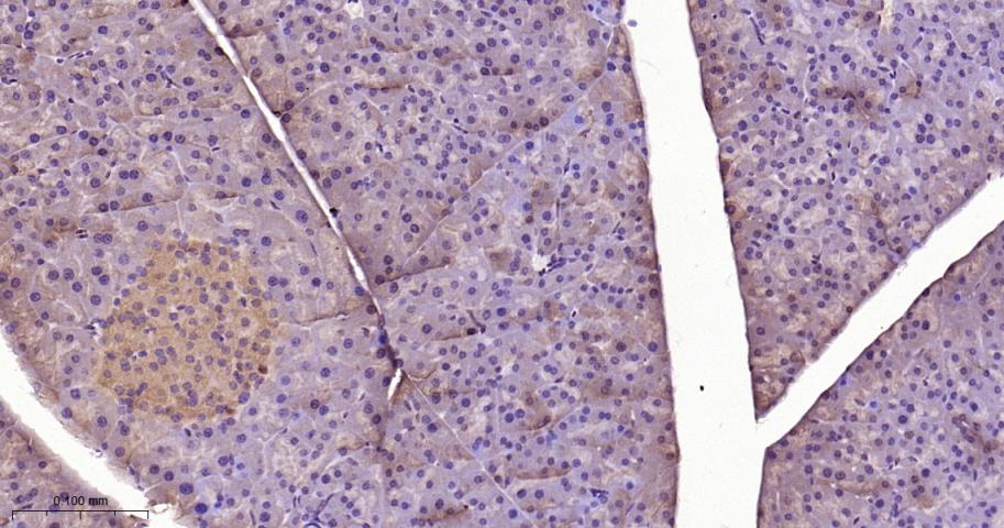 信号转导和转录激活因子3抗体-bs-20382R