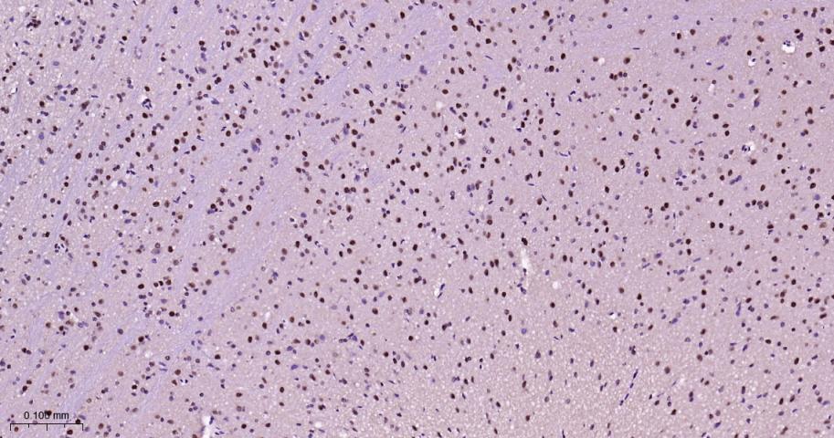 异染色质蛋白1-γ/HP-1γ重组兔单抗-bsm-61603R