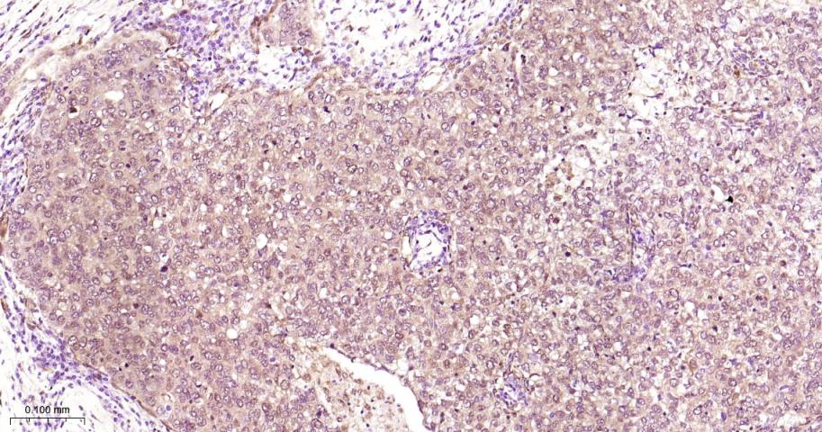 丝裂原活化蛋白激酶1/ERK 1/2重组兔单抗