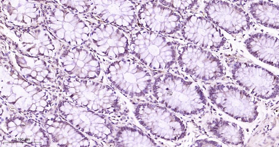 异染色质蛋白1-α重组兔单抗-bsm-61202R