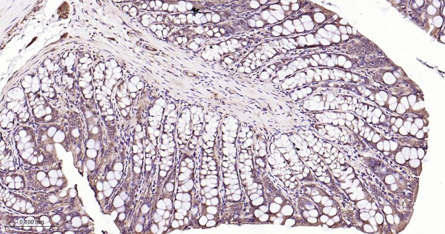 丝裂原活化蛋白激酶1/ERK 1/2重组兔单抗