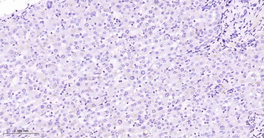 促肾上腺皮质激素重组兔单克隆抗体