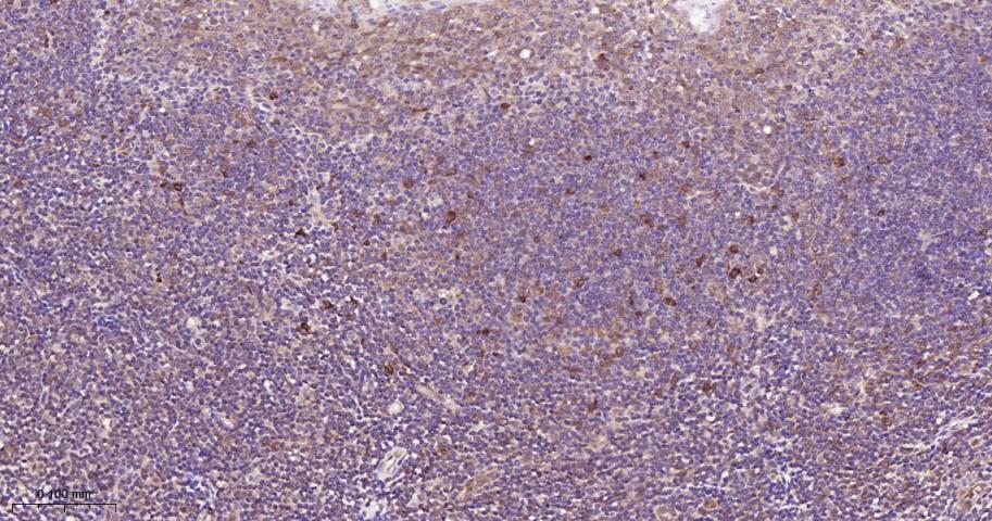 信号转导和转录激活因子3单克隆抗体-bsm-33218M