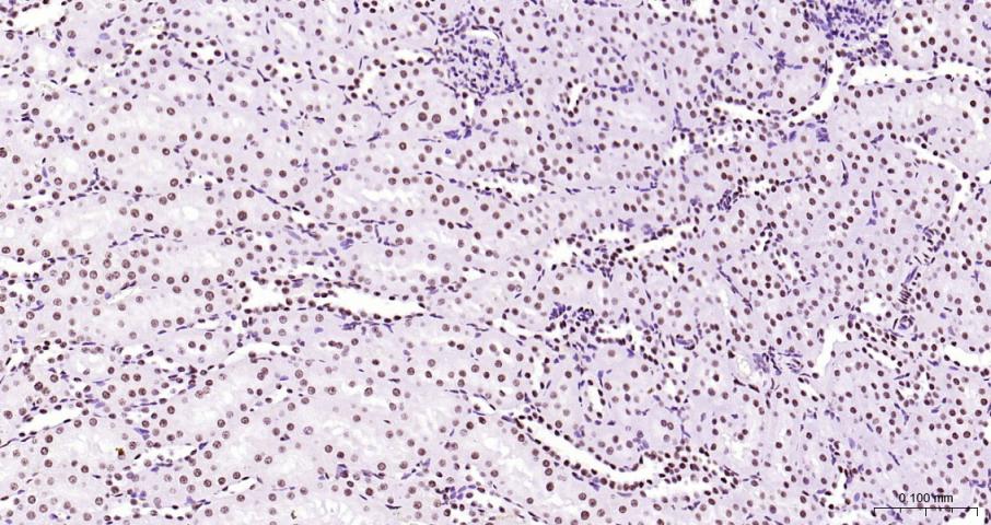 磷酸化RNA聚合酶II CTD重组兔单抗