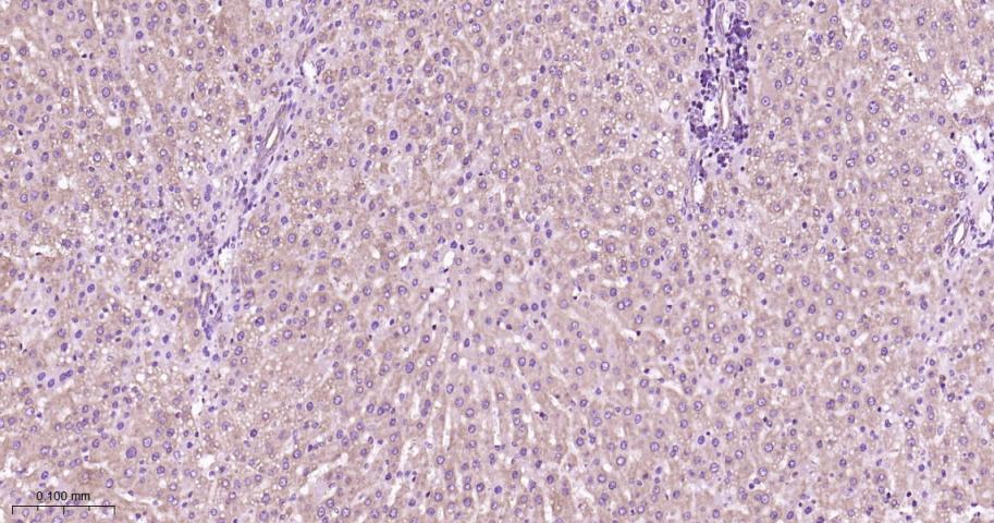 蛋白激酶C α重组兔单抗