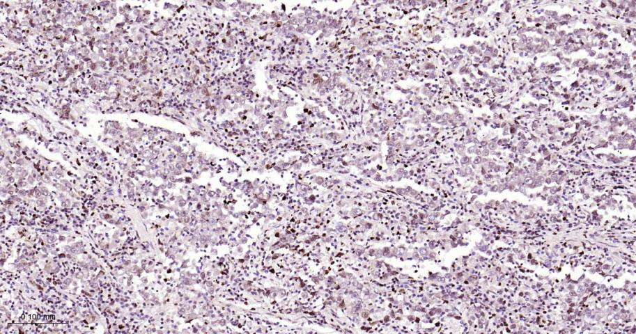 磷酸化细胞肿瘤抗原P53抗体-bs-3705R