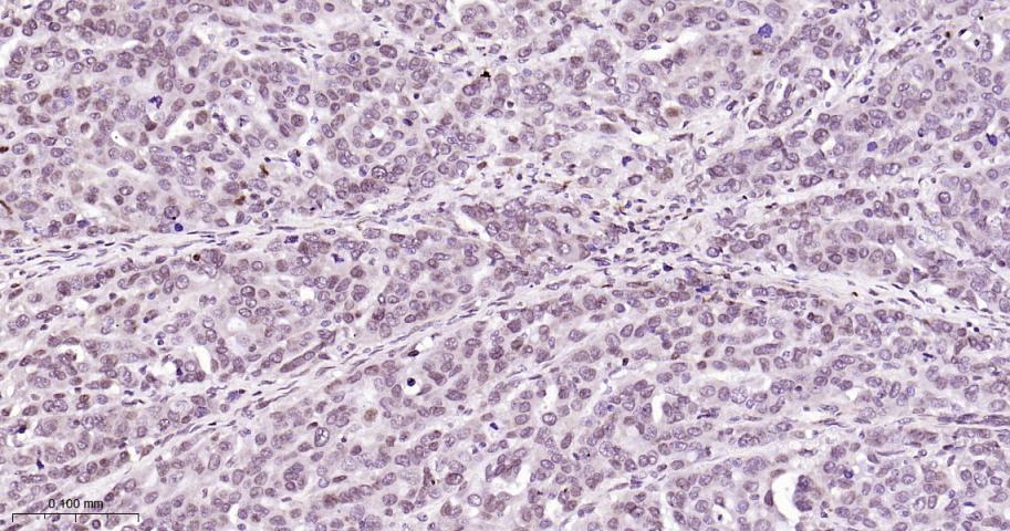 磷酸化细胞肿瘤抗原P53抗体-bs-3705R