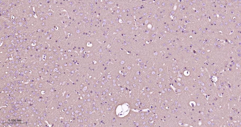 蛋白激酶C α重组兔单抗