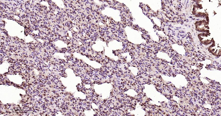 信号转导和转录激活因子3抗体-bs-20382R