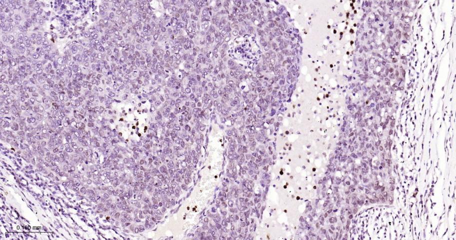 磷酸化细胞肿瘤抗原P53抗体-bs-3705R