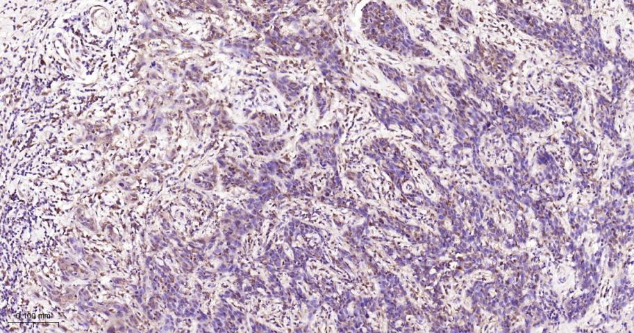 信号转导和转录激活因子3单克隆抗体-bsm-33218M