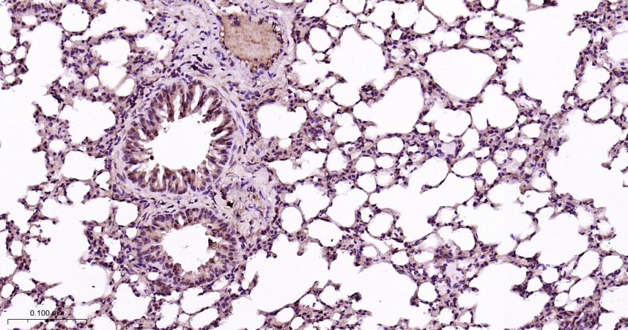 蛋白酶调解因子14重组兔单抗