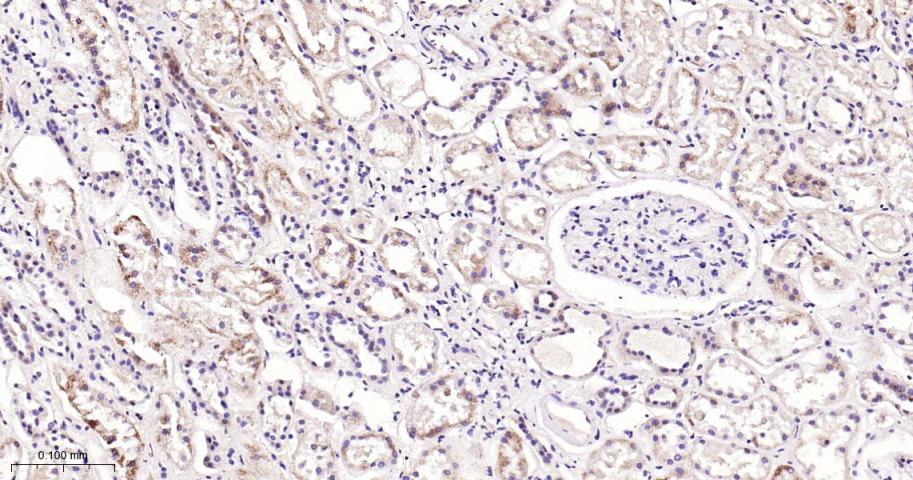 信号转导和转录激活因子3单克隆抗体-bsm-33223M