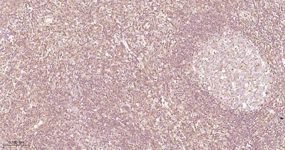 丝裂原活化蛋白激酶1/ERK 1/2重组兔单抗