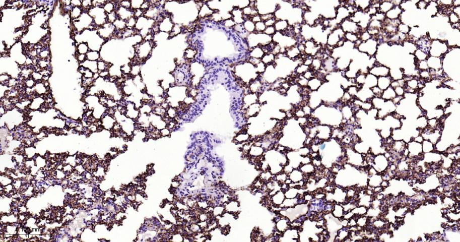 血栓调节蛋白重组兔单抗