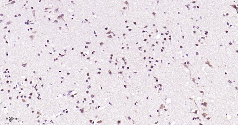 磷酸化信号转导和转录激活因子3抗体-bs-22386R