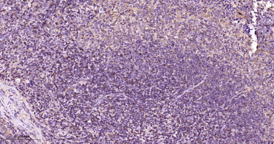 蛋白激酶C α重组兔单抗