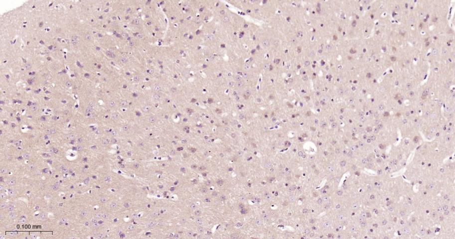 信号转导和转录激活因子3抗体-bs-20382R